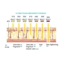 五大光子嫩膚技術（IPL、DPL、OPT、APT、BBL）及濾光片區別